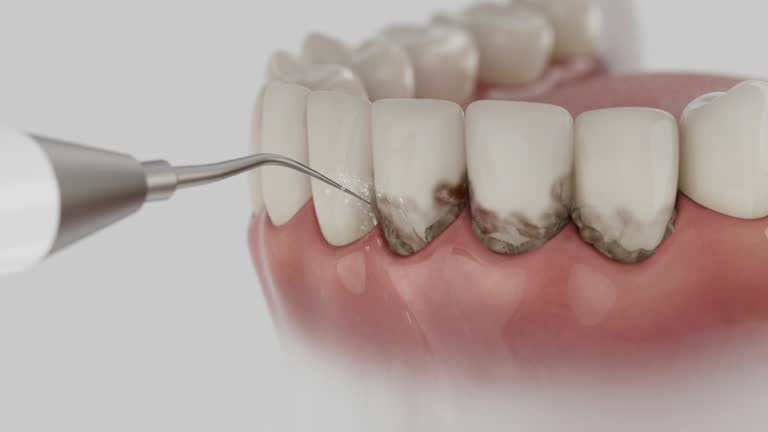 Trusted Tooth Extraction service in Troy Hills, NJ - Dentist Open Now
